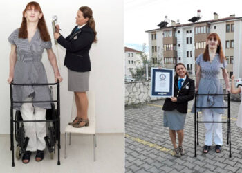 Turkish Rumeysa Gelgi is 7ft, 0.7 in tall; she breaks the world’s tallest records