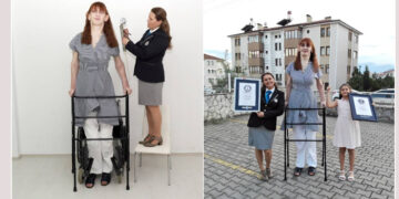 Turkish Rumeysa Gelgi is 7ft, 0.7 in tall; she breaks the world’s tallest records