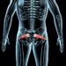 Piriformis muscle, trigger points, and pain