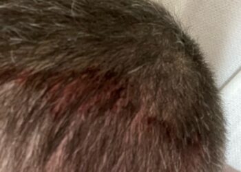 Broward County Father Denied Contact on Father’s Day: Family Court Stonewalling and DCF Investigations Leave Child at Risk